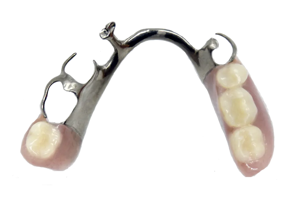 prothèse partielle Clinique de Denturologie Solutions Sourire Stefka Popova Prothèse dentaire partielle