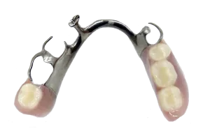 prothèse partielle Clinique de Denturologie Solutions Sourire Stefka Popova Prothèse dentaire partielle