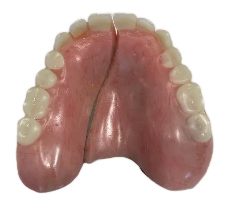 réparation clinique de Denturologie Solutions Sourire Stefka Popova réparation clinique de Denturologie Solutions Sourire Stefka Popova